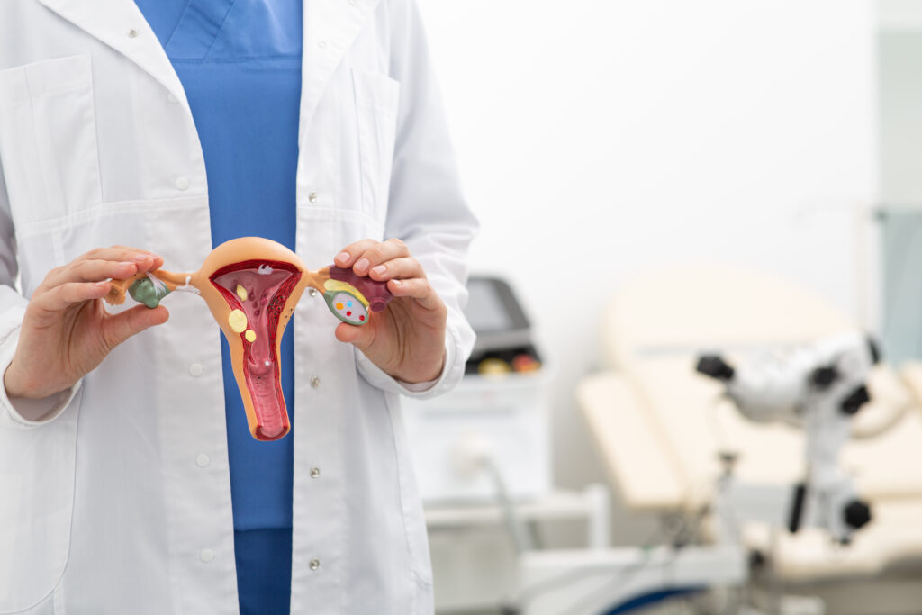 Intramural Fibroid
