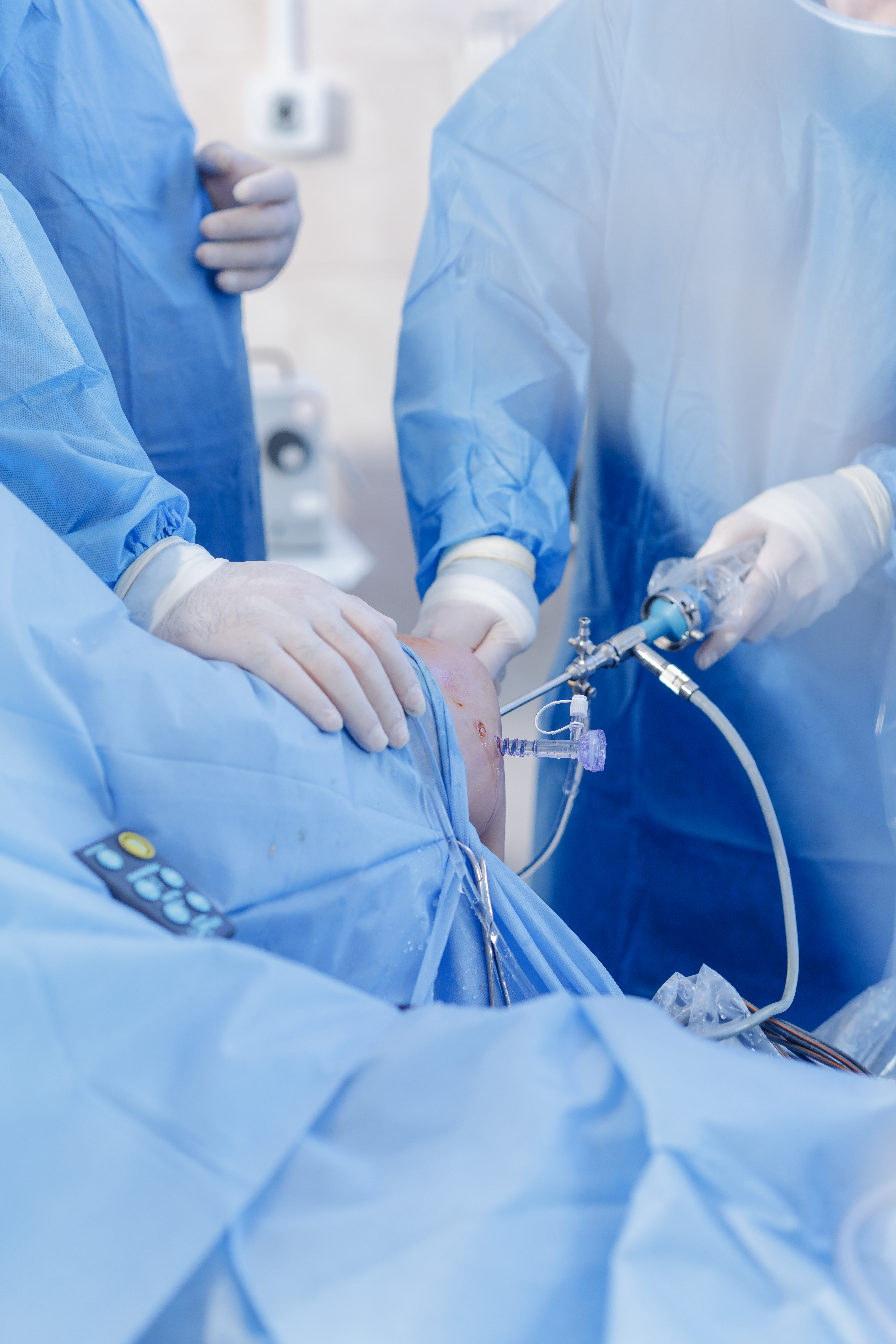 Laparoscopic surgery in progress in an operating room